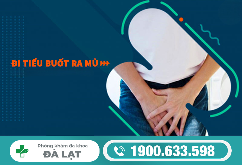 Hình ảnh minh họa